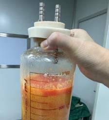 格尔木水动力吸脂手术要做多久？